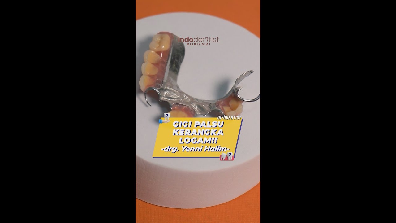 GIGI PALSU KERANGKA LOGAM (FRAME DENTURE)