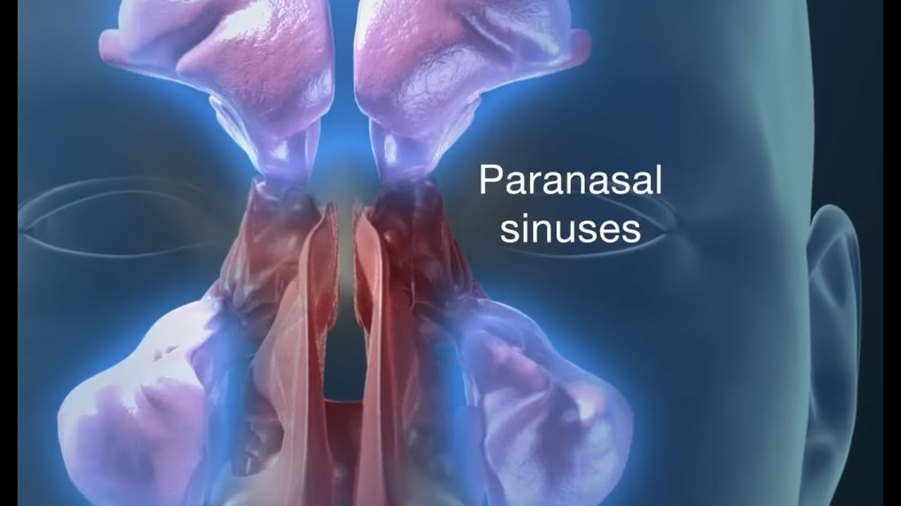 Endoscopic Sinus Surgery for Pain, Drainage, Infections, and Impaired breathing