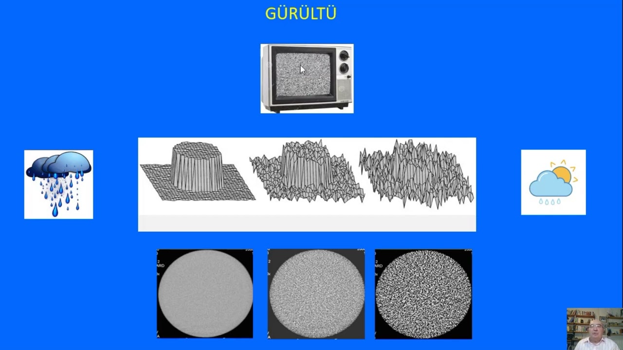 Konu 7-2 Radyografik görüntülerin kalitesi ne demektir ?