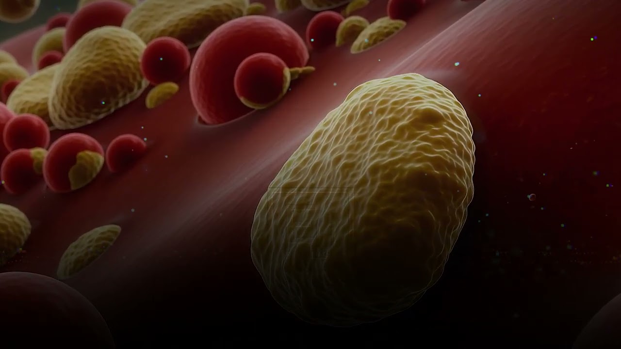 Si ndikon veza ndaj kolesterolit dhe diabetit