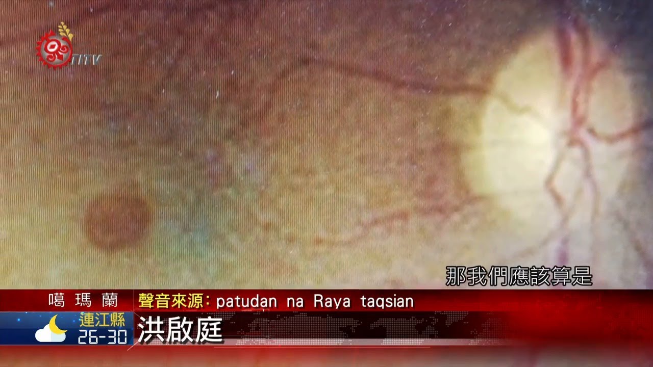 男海邊日光浴 忽略海水折射陽光視力受損 2020-07-28 Kavalan IPCF-TITV 原文會 原視族語新聞
