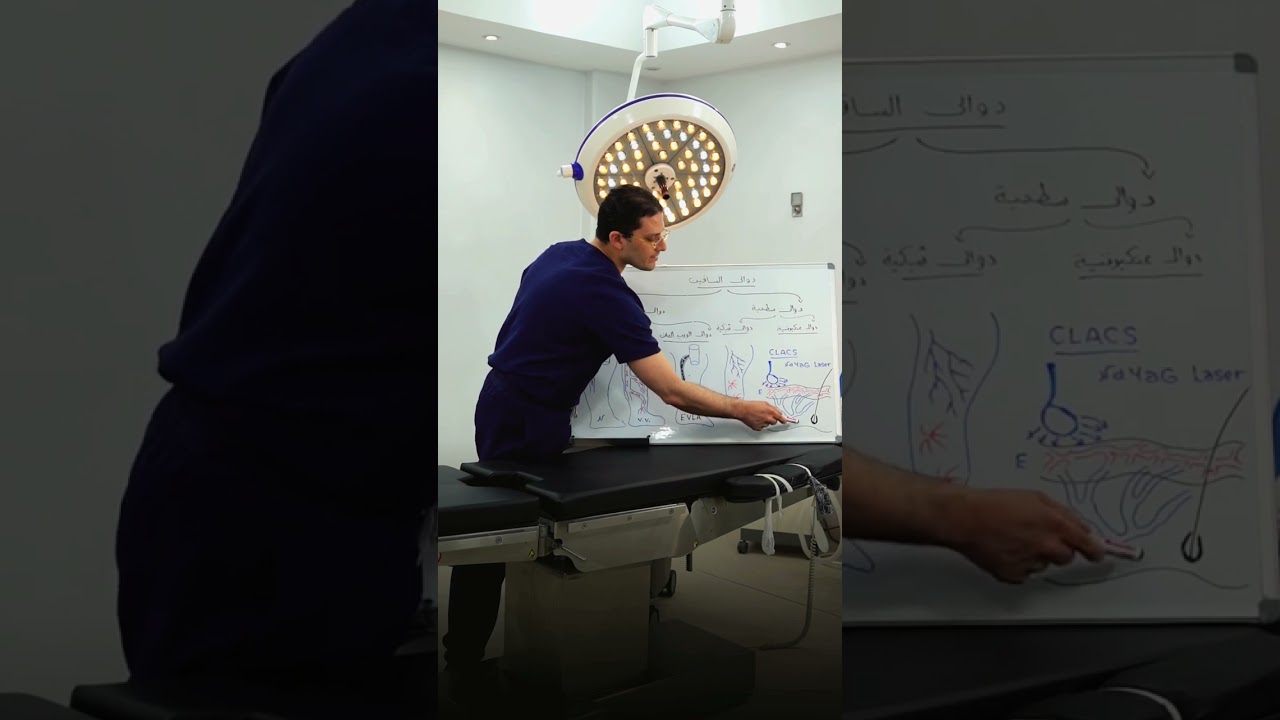 دوالي الساقين مش شكل وبس أنواع وأسباب وطرق علاج من غير جراحة  شوف الفيديو للآخر