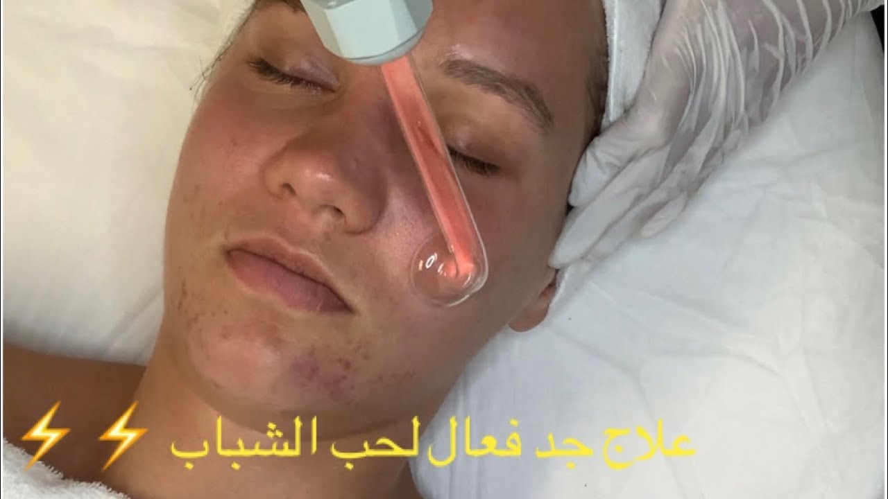 علاج فعال لحب الشباب والحبوب الهرمونية  #Vlog #HydraFacial #LedLightTherapy #HighFrequency ⚡️⚡️