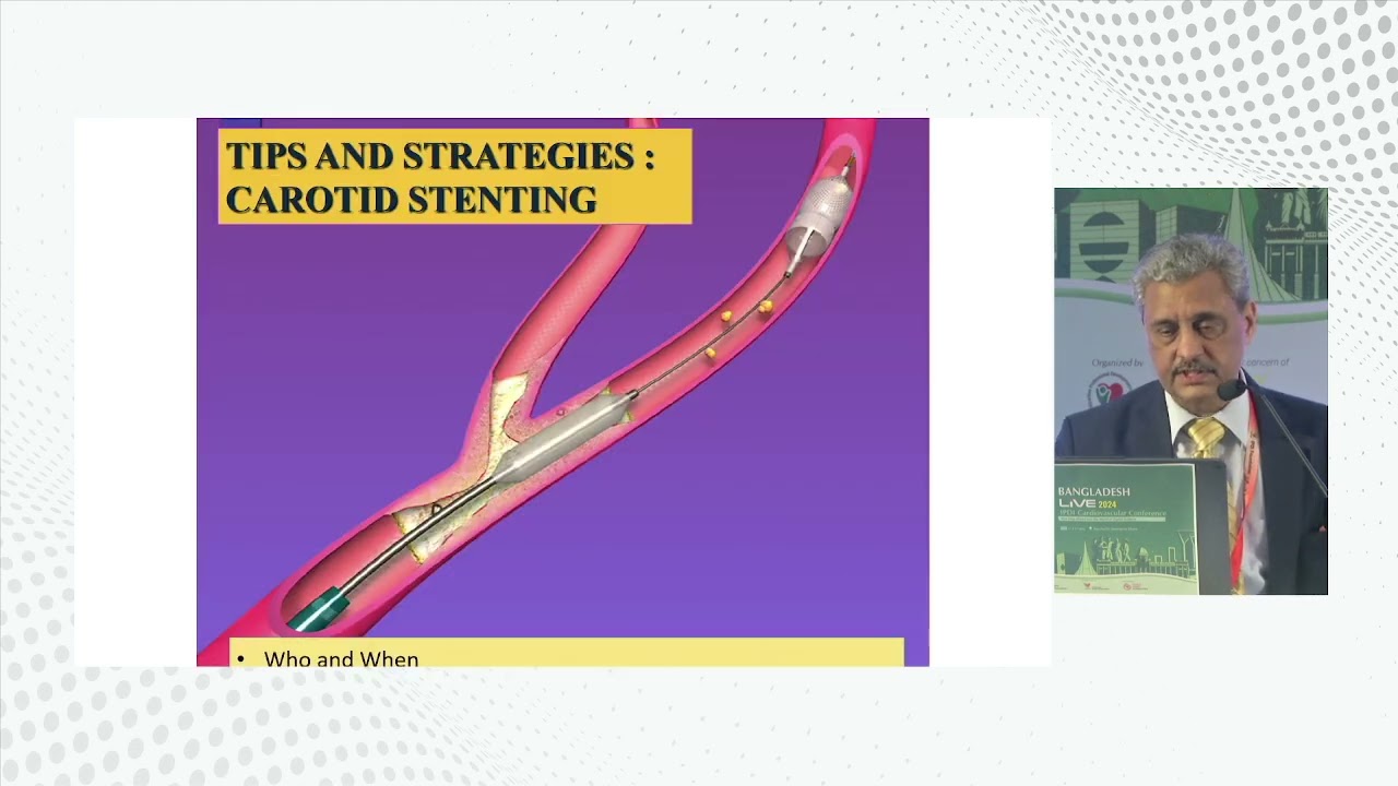 Carotid Intervention : When & How by  Dr  Atul Mathur