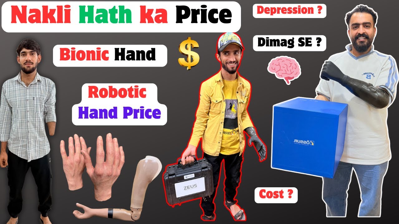 🦾Bionic Hand Price | Nakli Hath Cost | Aether Zeus Hand | Myoelectric Hand | #ossur #ottobock #3r80
