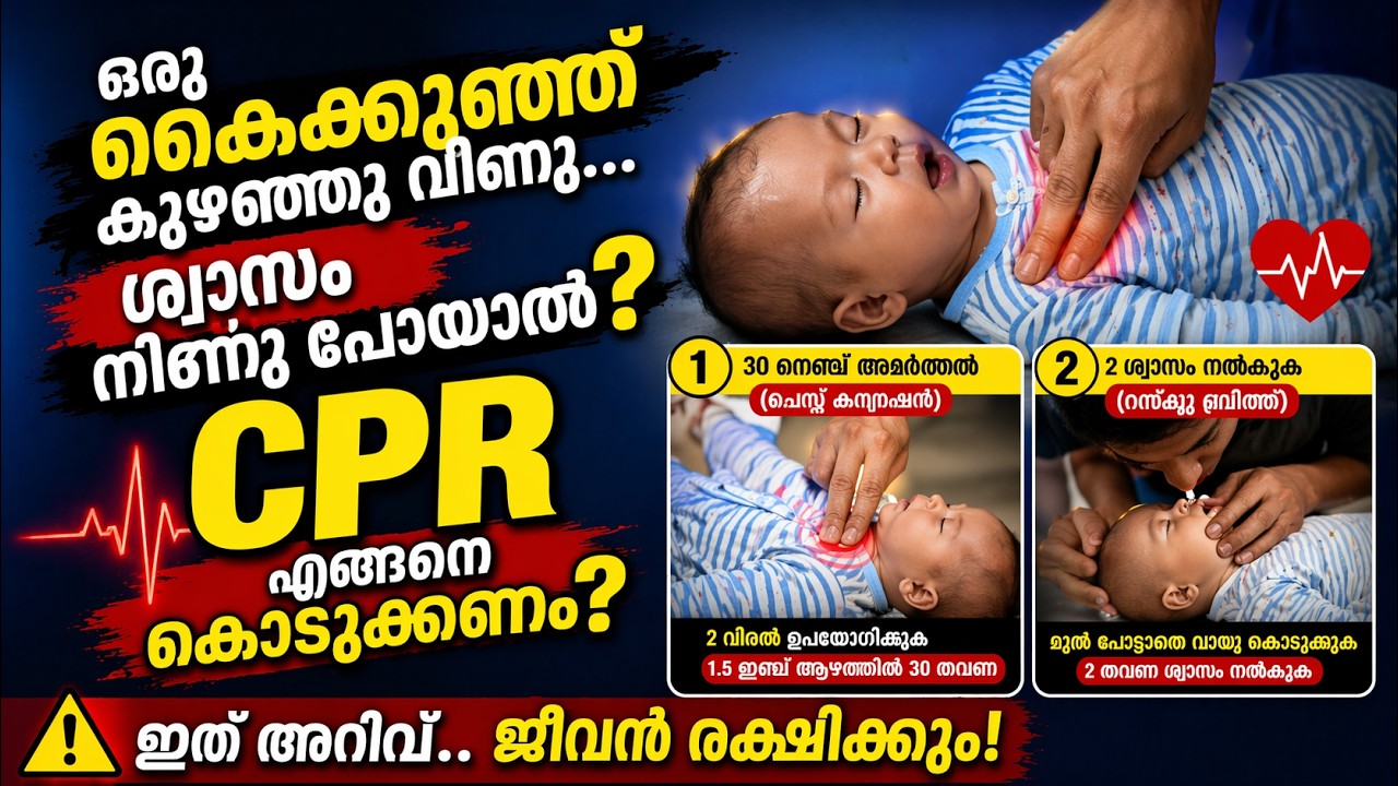 ഒരു കൈക്കുഞ്ഞ് കുഴഞ്ഞു വീണു ശ്വാസം നിന്നു പോയാൽ എങ്ങിനെ CPR കൊടുക്കണം?