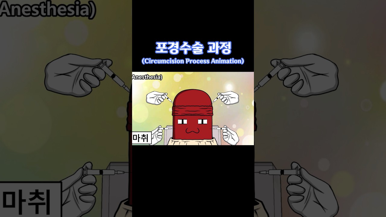 포경수술 과정 애니메이션/How Circumcision Works | Medical Procedure Explained (Animated)