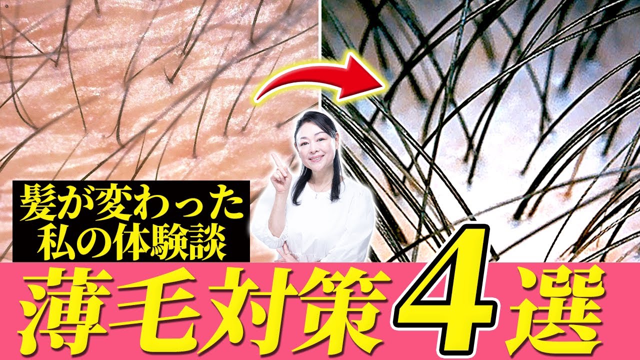 【40代薄毛対策】私がボリューム復活できた頭皮ケア4選｜抜け毛・髪痩せ改善【50代60代にも】