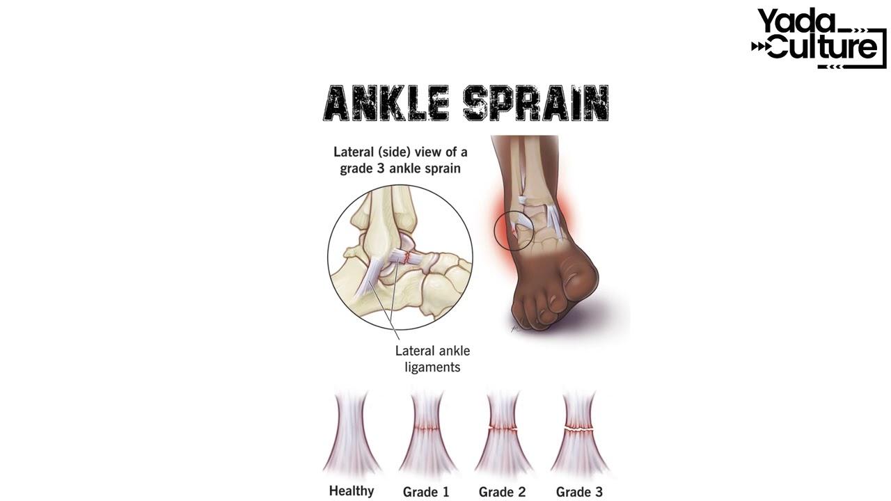 Understanding Common Sports Injuries and Their Causes