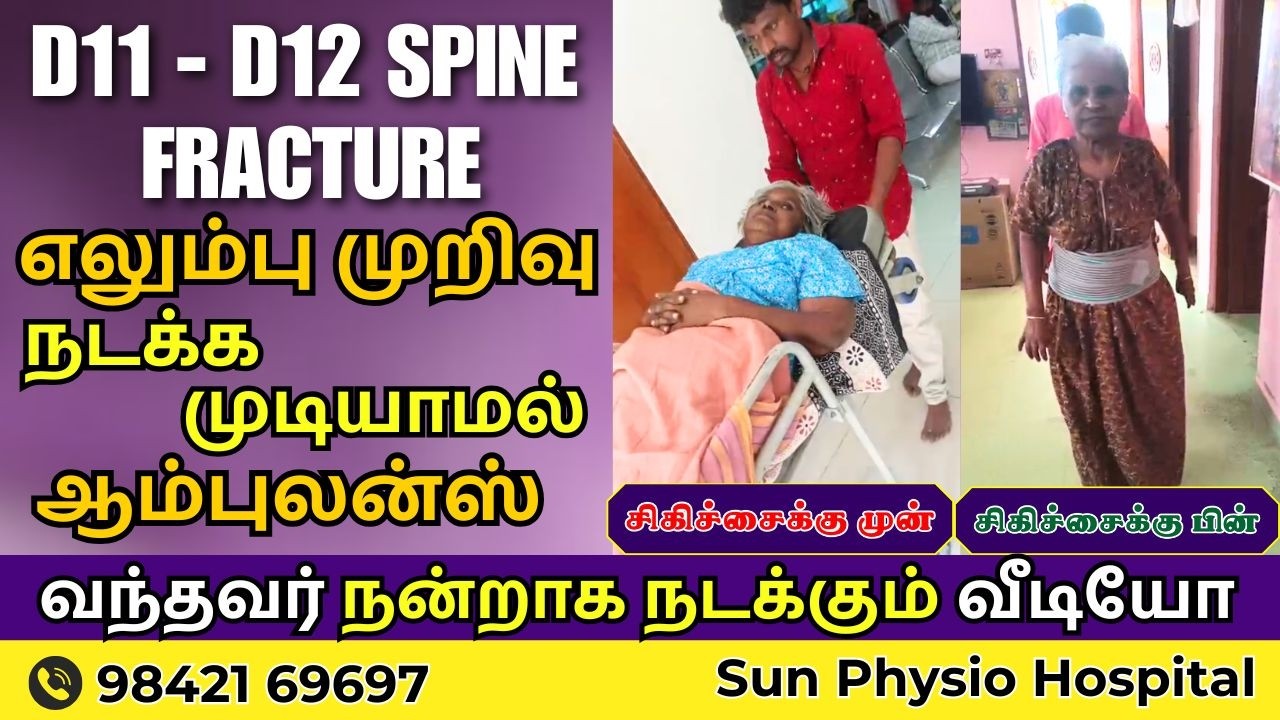 D11-D12 Spine Fracture 😢 படுக்கையில் இருந்த Patient… இப்போது நன்றாக நடக்கிறார்! | Sun Physio