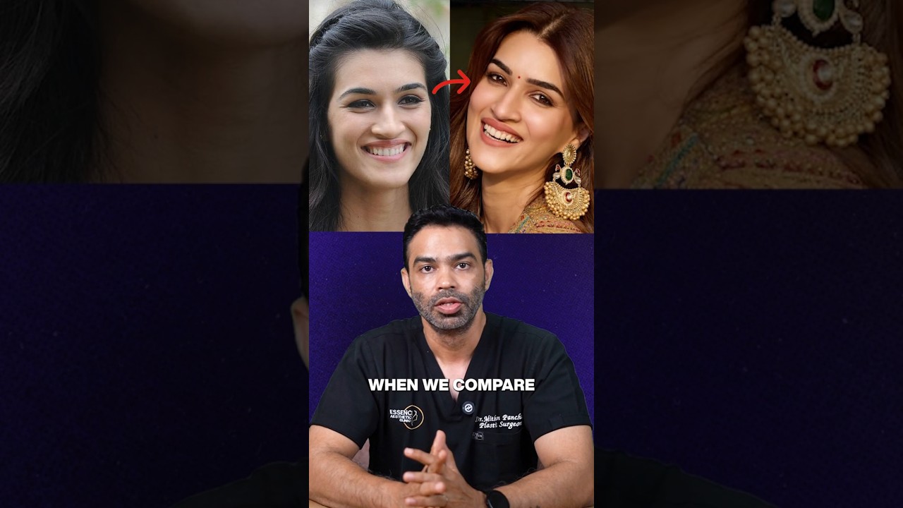 Have you noticed Kriti Sanon&rsquo;s smile makeover?
