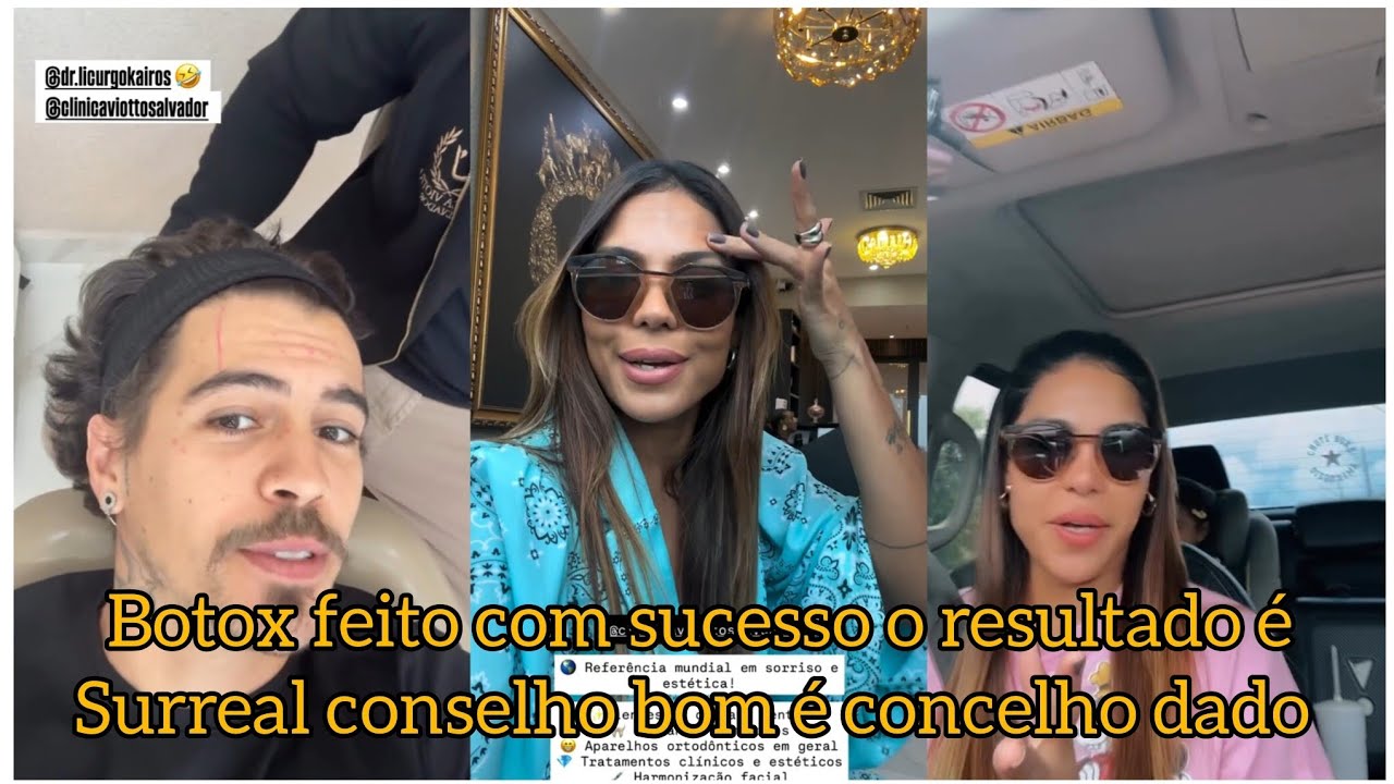 Botox feito com sucesso.  o resultado é surreal,  conselho bom é conselho dado 