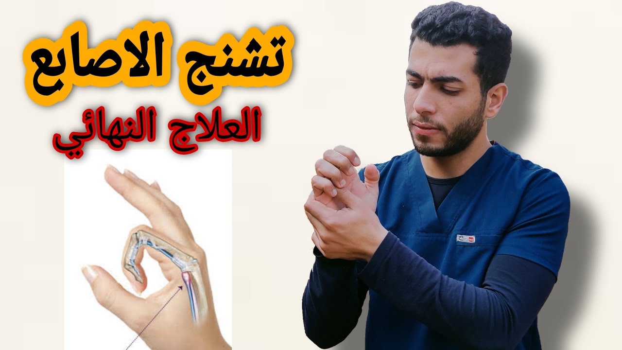 علاج الاصبع الزنادى| تصلب والم اصبع الابهام| تشنج الاصبع الاوسط لليد