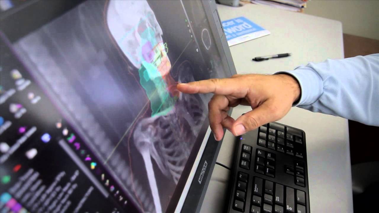 TomoTherapy radiation treatment system at Swedish