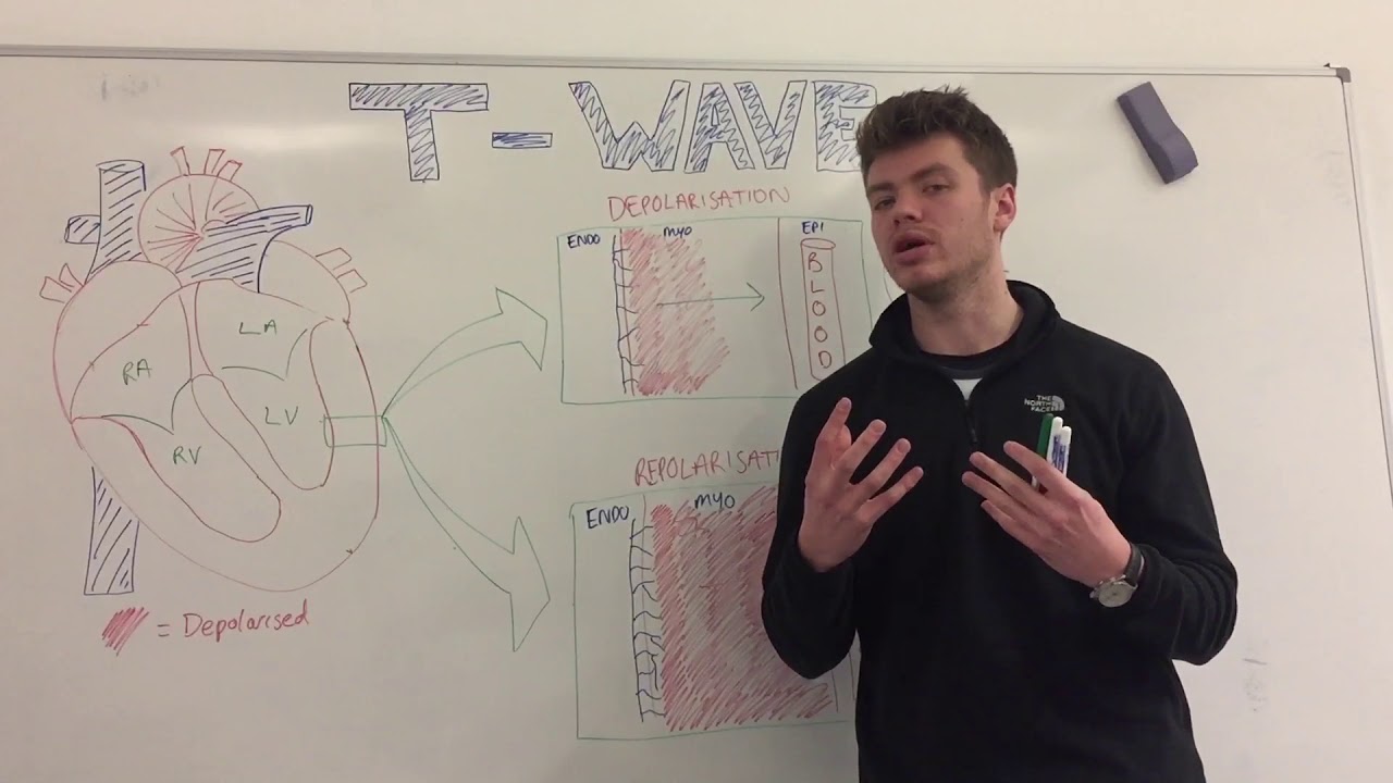 T Wave Explained