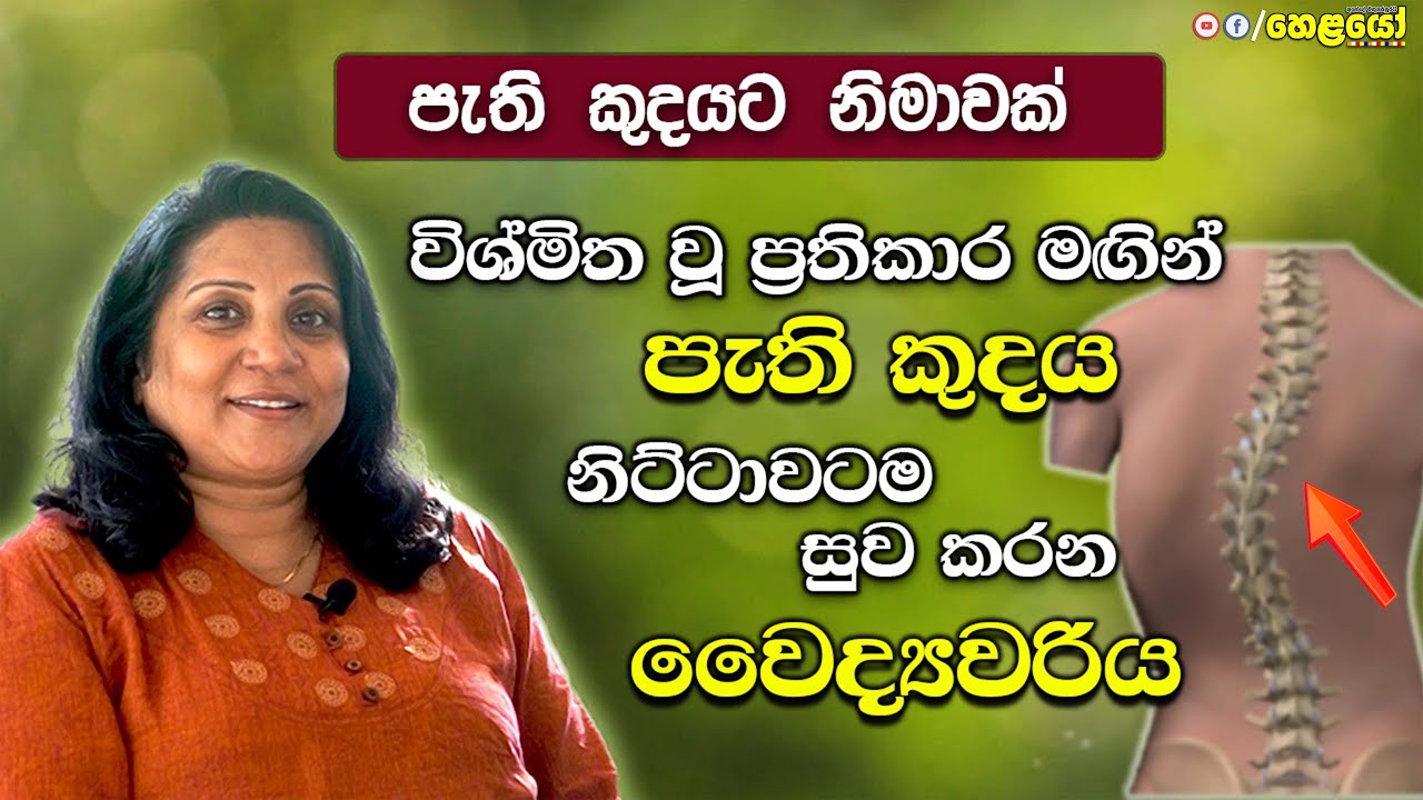 පැති කුදය හෙවත් කොදු ඇට පෙල ඇදවීමේ රෝගයට නිශ්චිත ප්‍රතිකාර - Ayurvedic treatments for Scoliosis