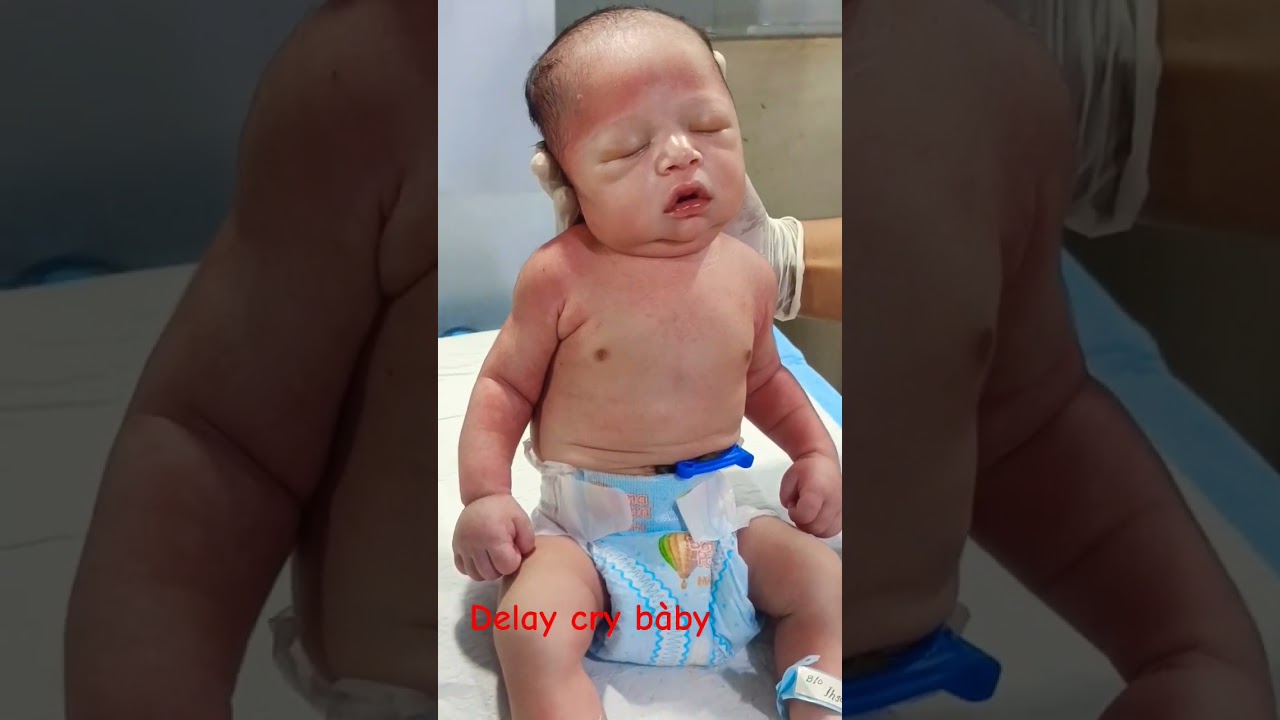 cute baby with delay crying #birth asphyxia #cutebabypoor reflexes