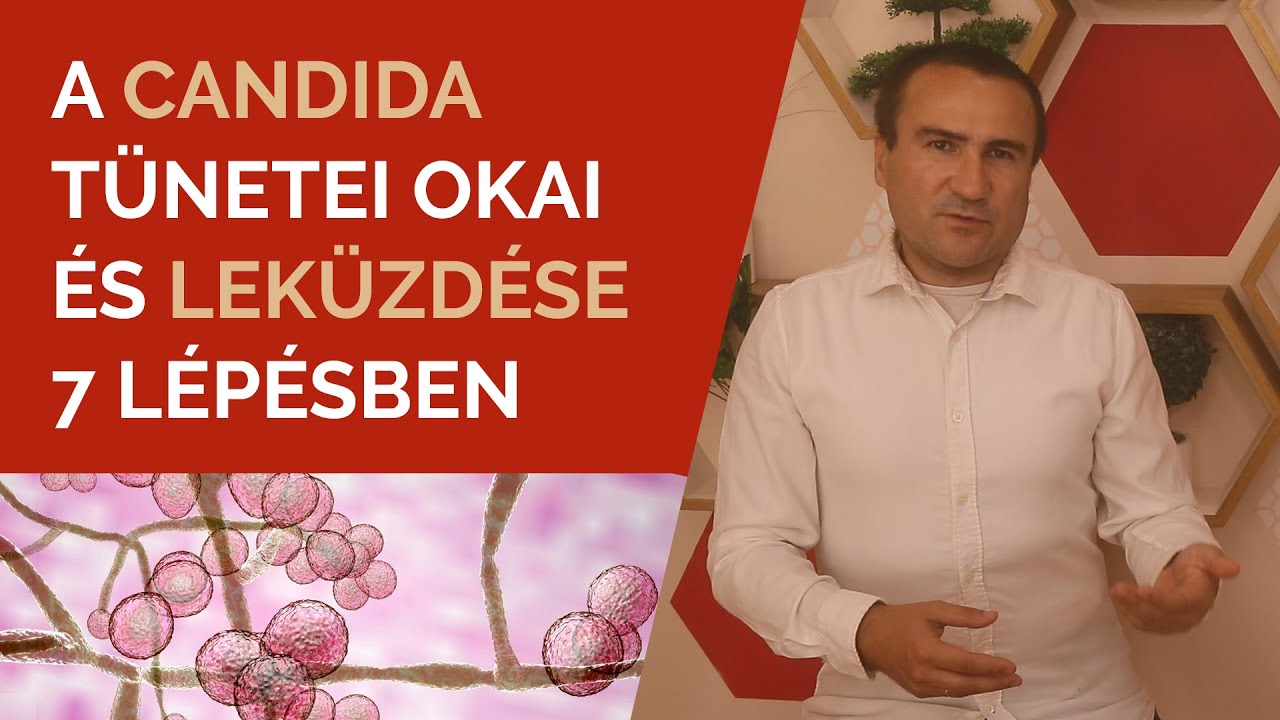 A candida tünetei, okai és leküzdése 7 lépésben