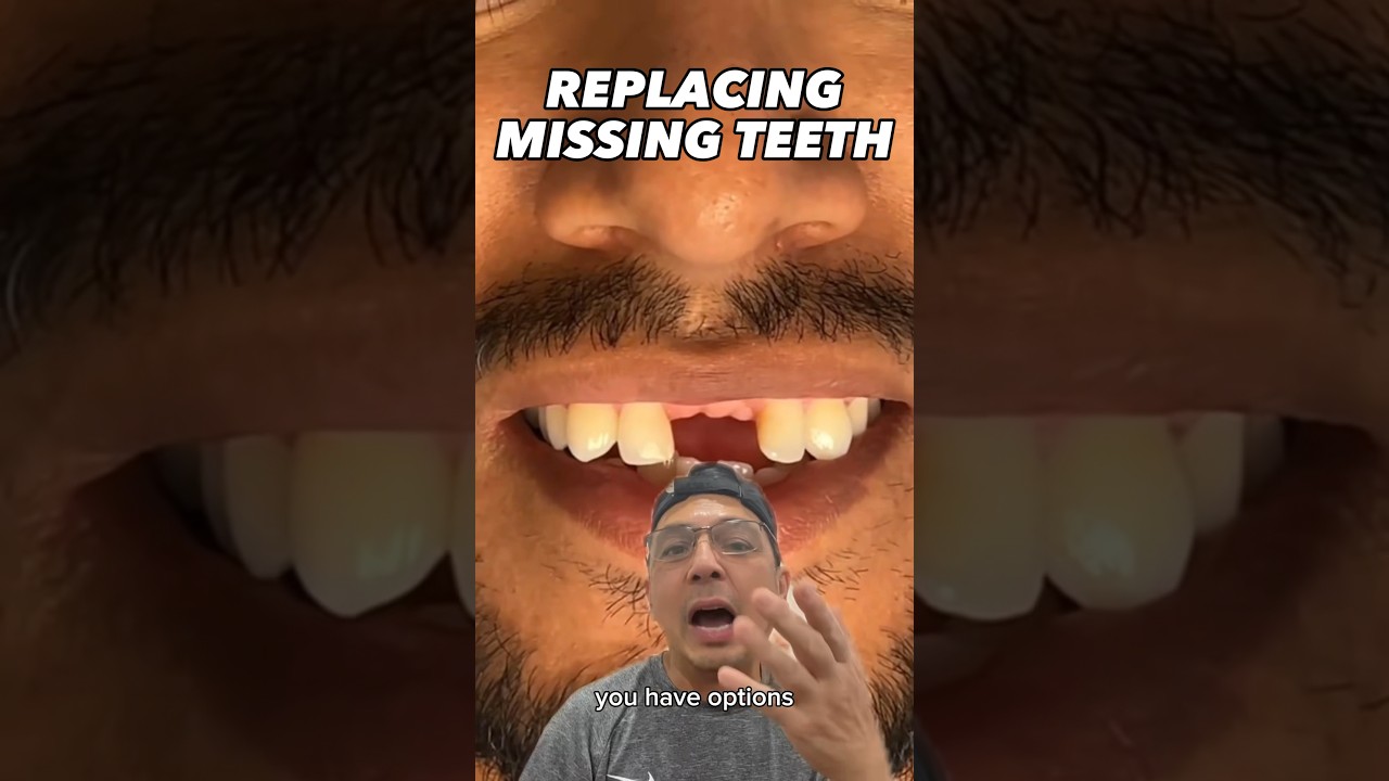 Options to Replace Missing Front Teeth | View Mobile Dental #shorts