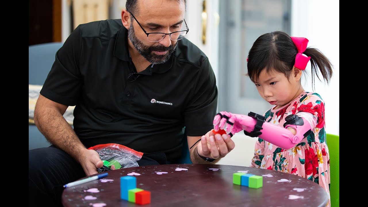 UNO's Biomechanics helps child with 3D-printed prosthesis