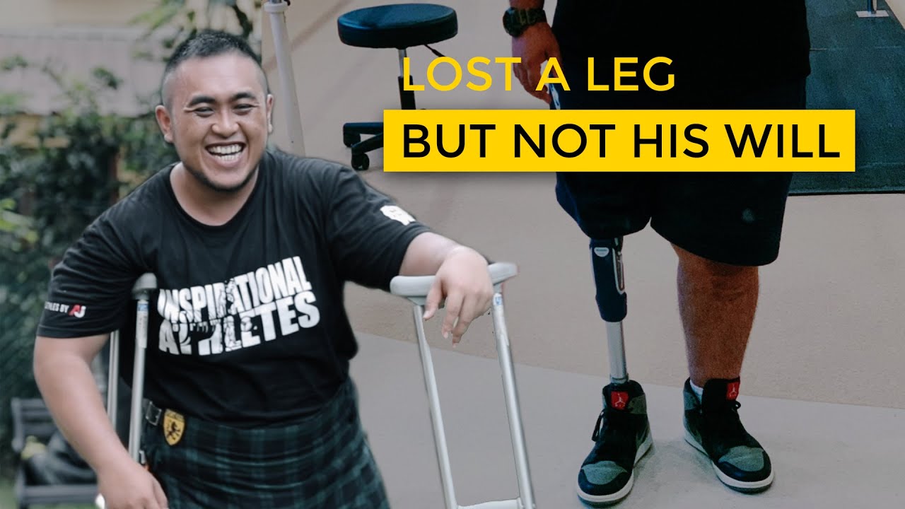 Losing A Leg But Not His Will