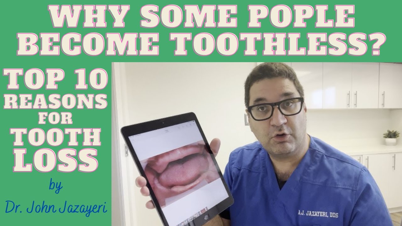 Why Some People Become Toothless? Top 10 Reasons For Tooth Loss in Adults