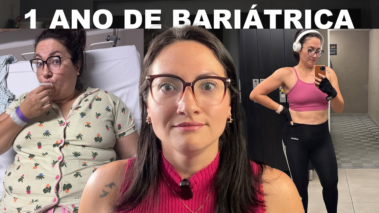 1 ANO DE BARIÁTRICA