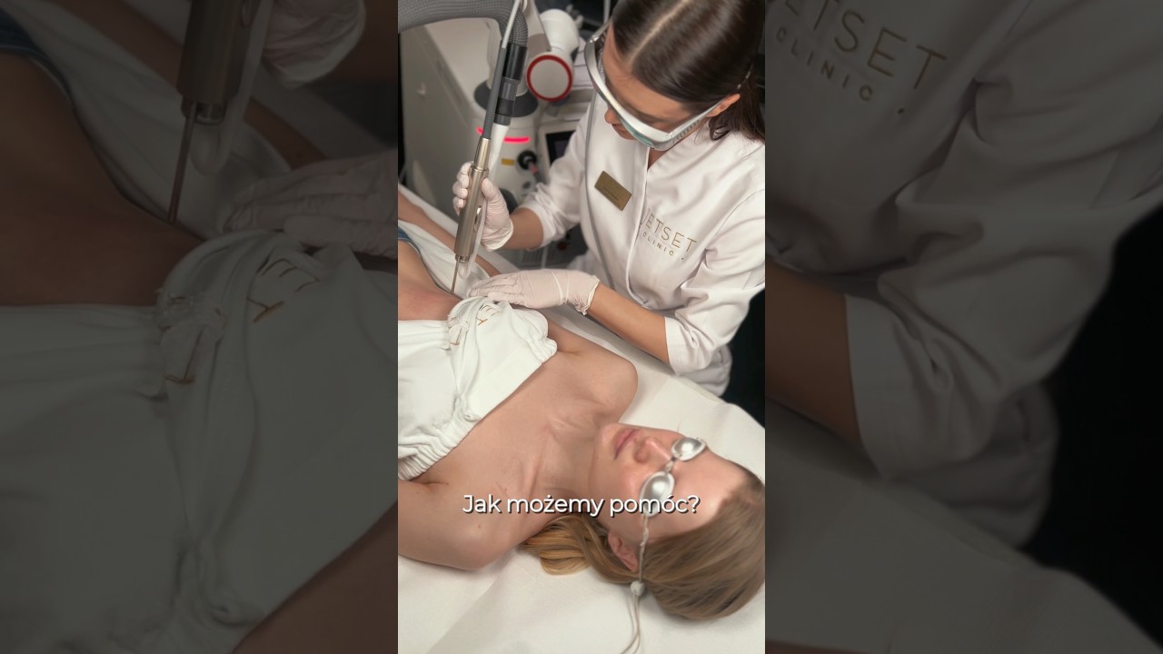 🫟Przebarwienia po oparzeniach