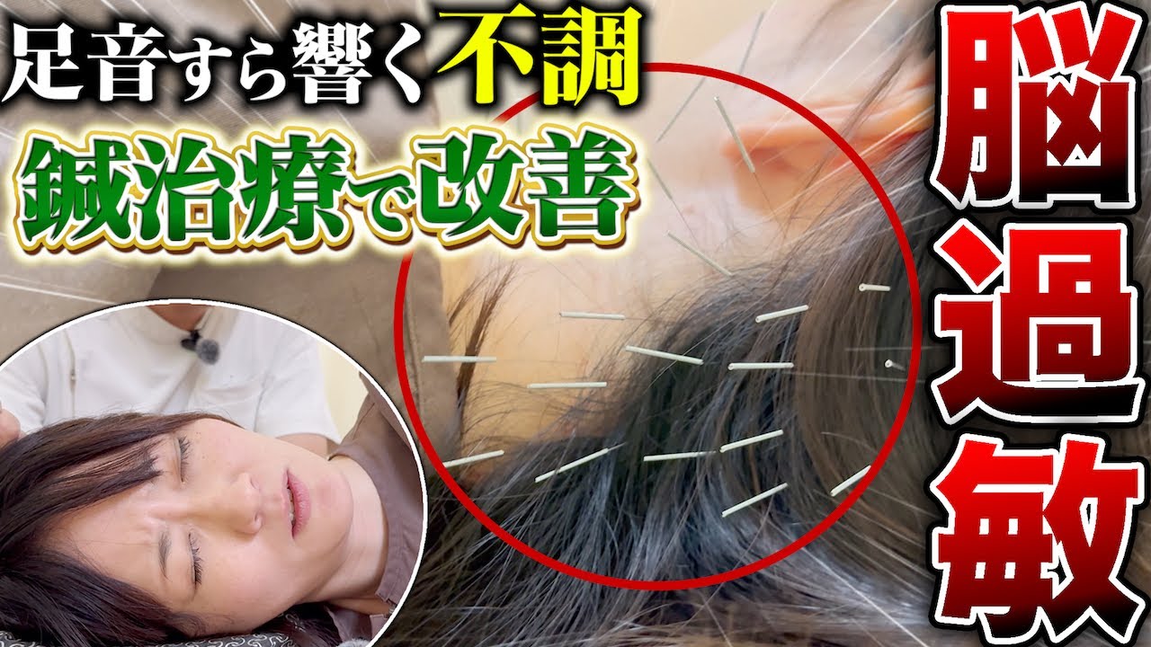 「足音すら響いてツラい…」脳過敏の苦しみを鍼治療で改善！