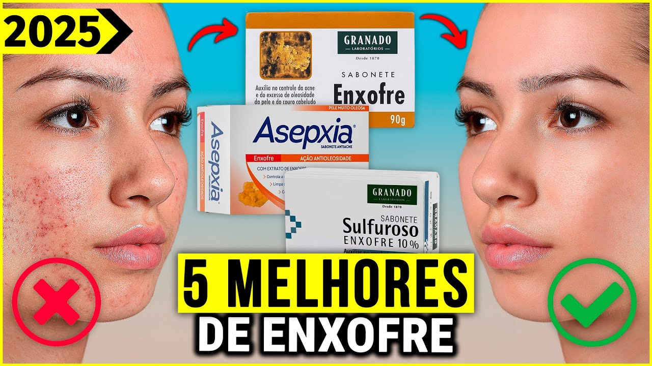 Os 5 Melhores Sabonete De Enxofre Em 2025!