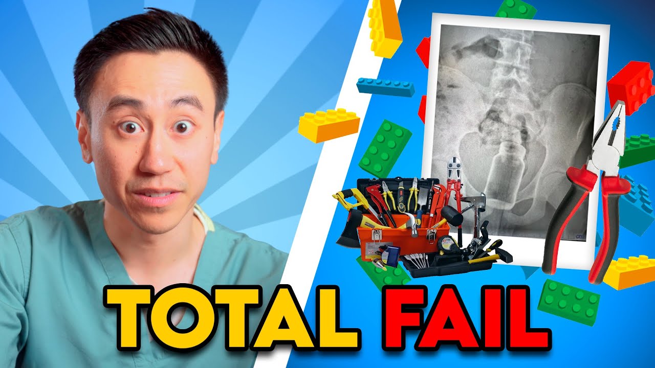 PARENT FAILS! Reasons Kids Go To The ER