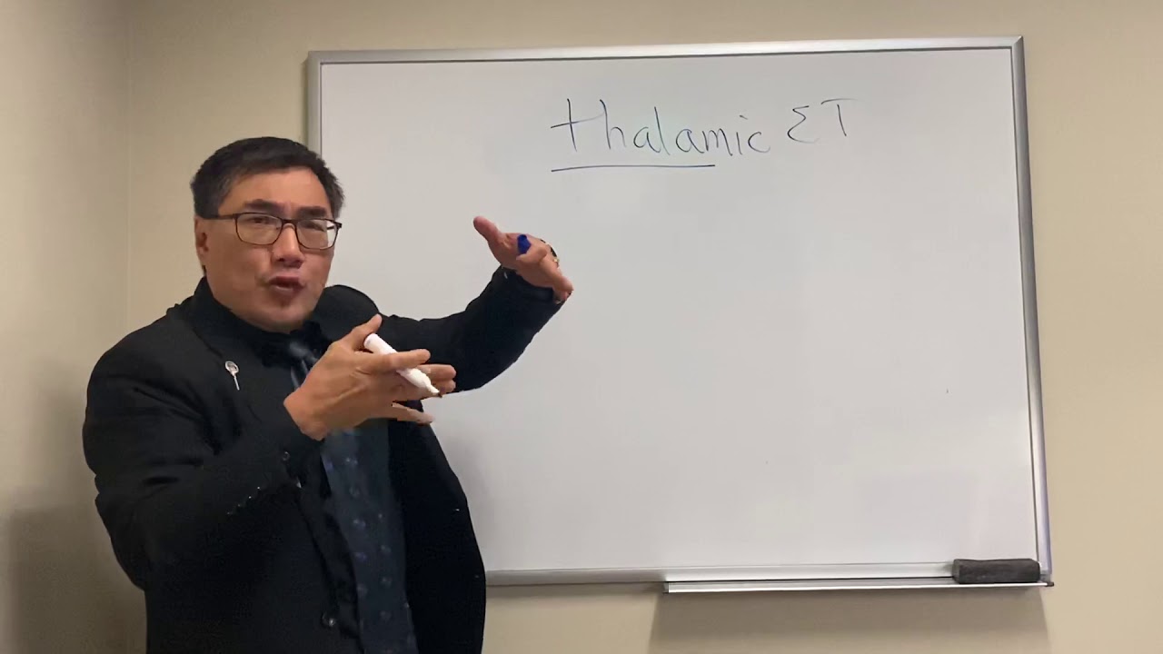 Thalamic Esotropia