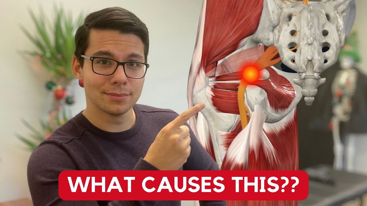 What's Causing Your Shooting Leg Pain?