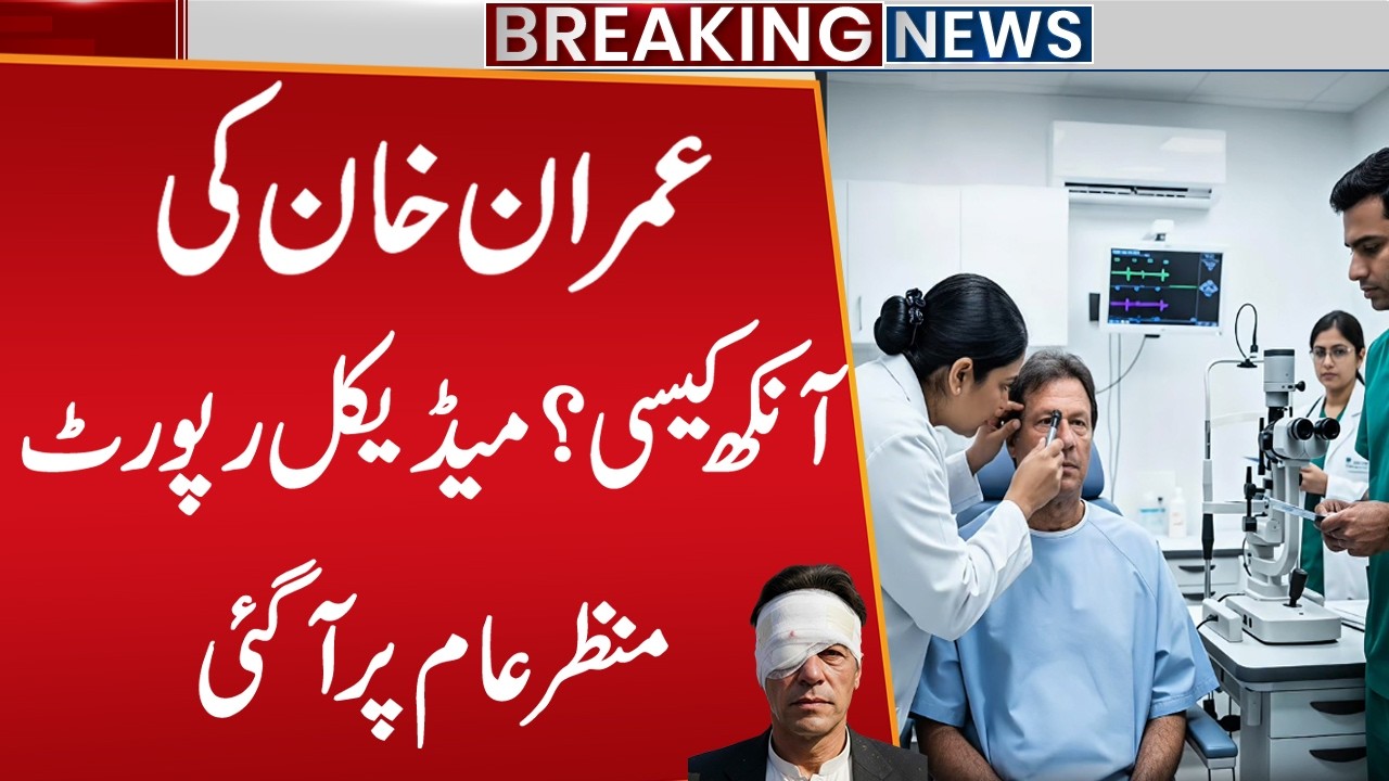 Imran Khan’s Eye Medical Report | Eye Treatment | Big News For PTI | Breaking News | Public News