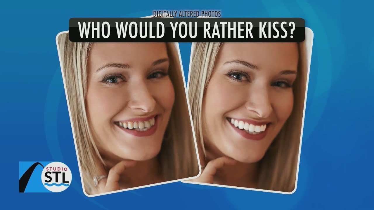 Power Swabs oferuje 40% zniżki na wybielanie zęb&oacute;w, aby uzyskać jaśniejszy uśmiech