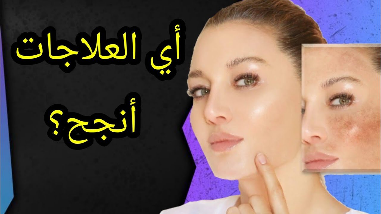 شنو اللي كيخلي العلاج ينجح؟المنتوجات الاقتصادية أو الباهظة🤔وصفات طبيعية ام علاج كيميائي🧐