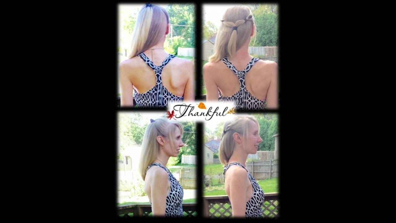 Scoliosis Treatment Comparison Pics - ScoliosisKC