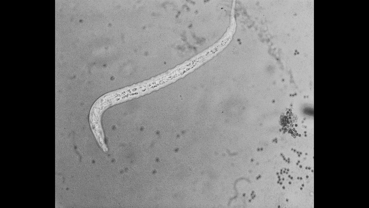 Nemátodo vs Trichoderma spp.