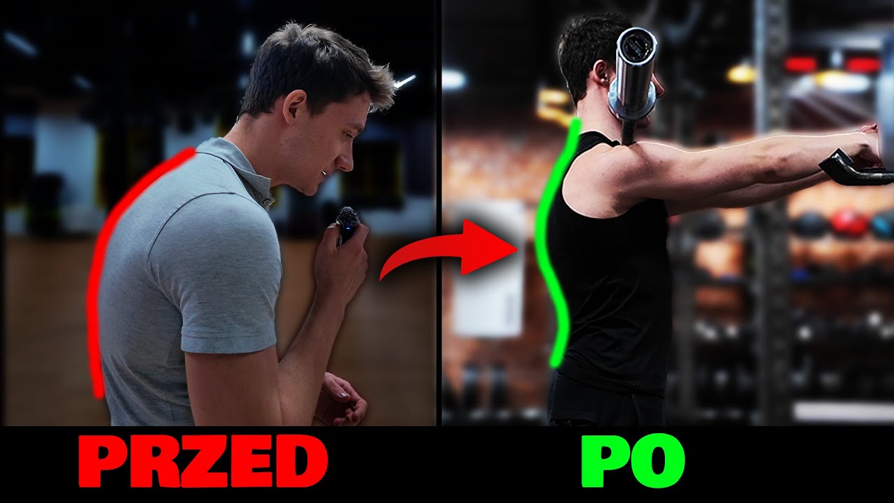 JAK POZBYŁEM SIĘ GARBA W 2 TYGODNIE! -  Te ćwiczenia naprawdę działają.