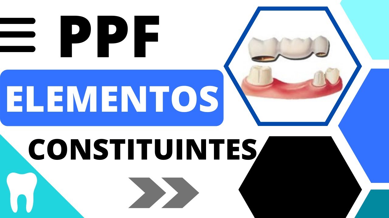 PRÓTESE PARCIAL FIXA | comece por aqui