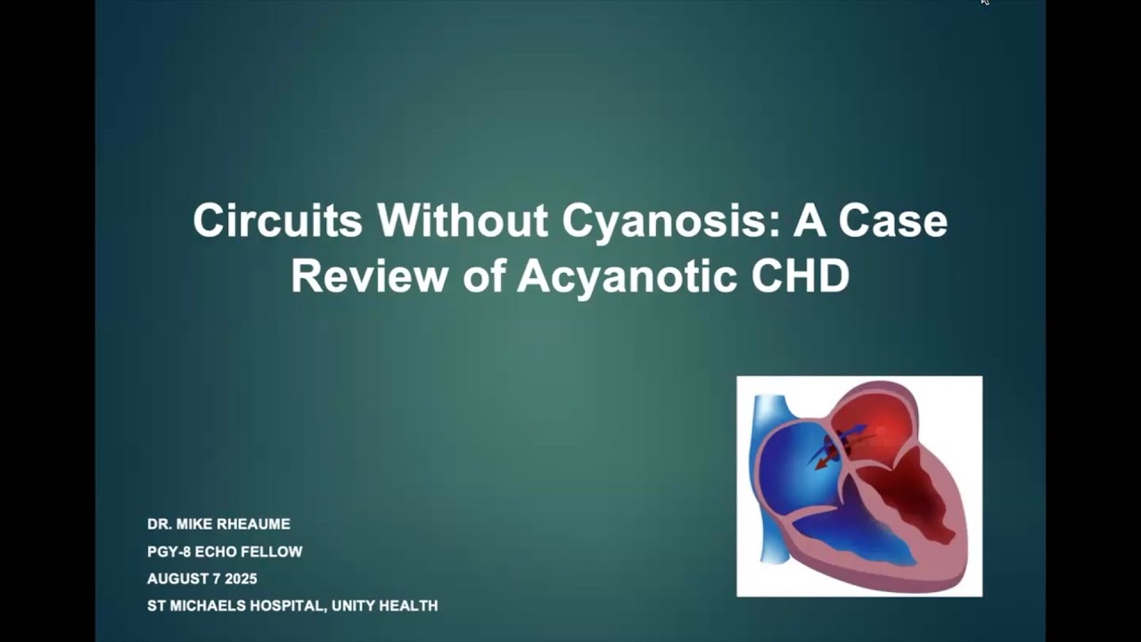 Circuits Without Cyanosis: A Case Review of Acyanotic Congenital Heart Disease (CHD)