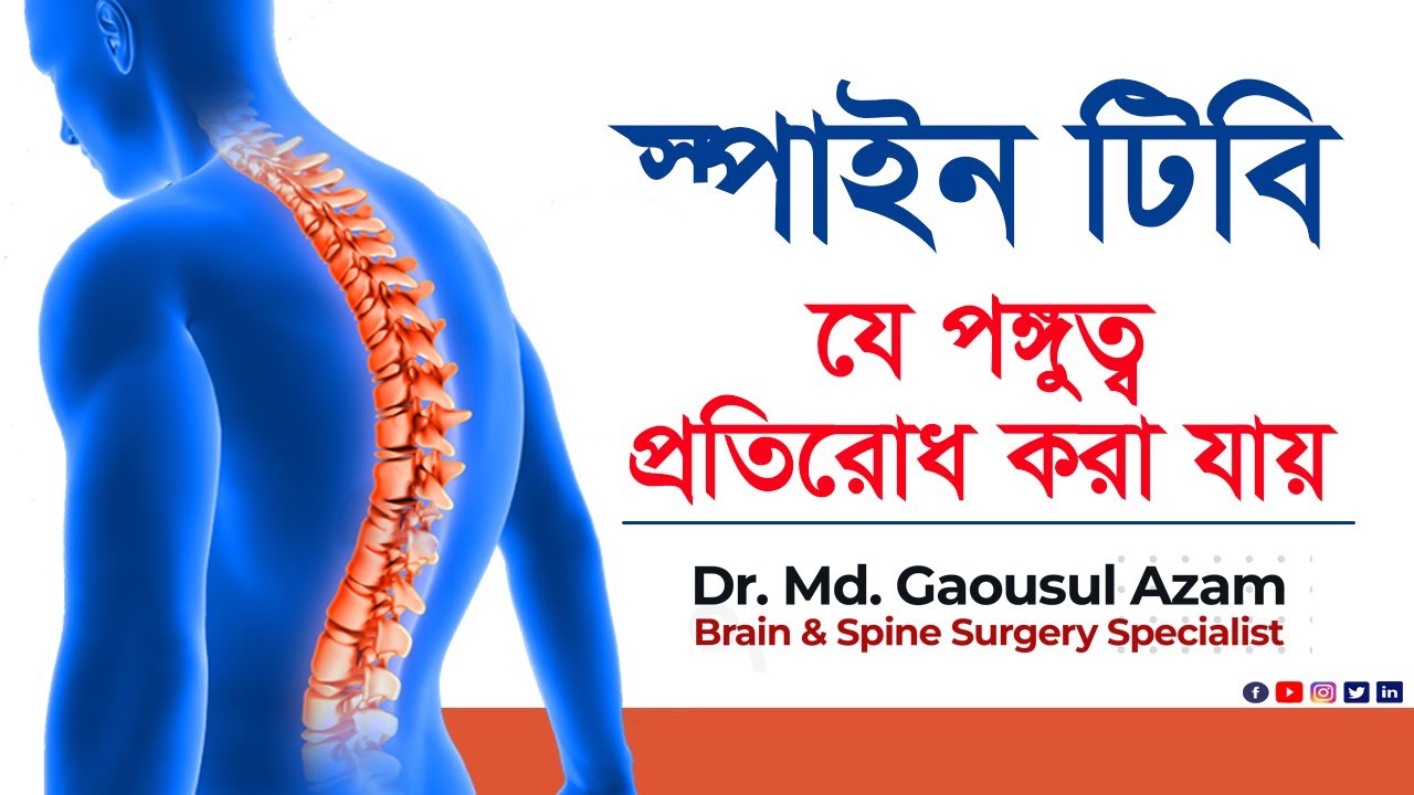স্পাইন টিবিঃ যে পঙ্গুত্ব প্রতিরোধ করা যায়! ডাঃ মোঃ গওছুল আযম