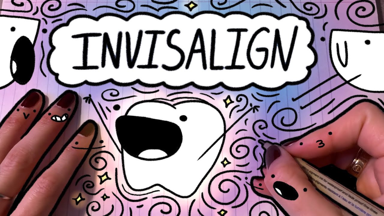 Мой 9-месячный путь к Invisalign (объяснение в картинках)