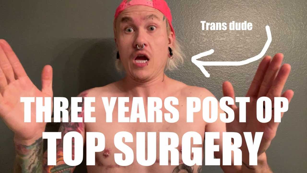 I had TOP SURGERY 3 years ago!!