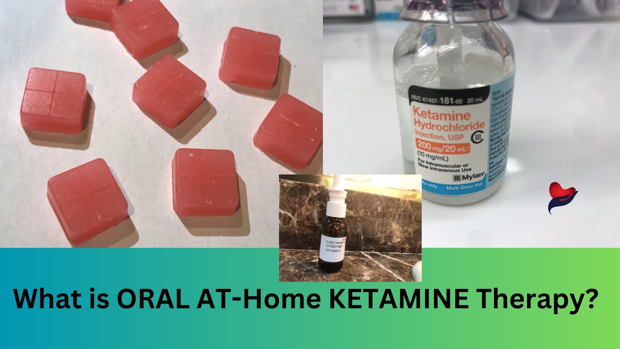 I tried oral ketamine for depression - At home ketamine therapy using oral ketamine troches