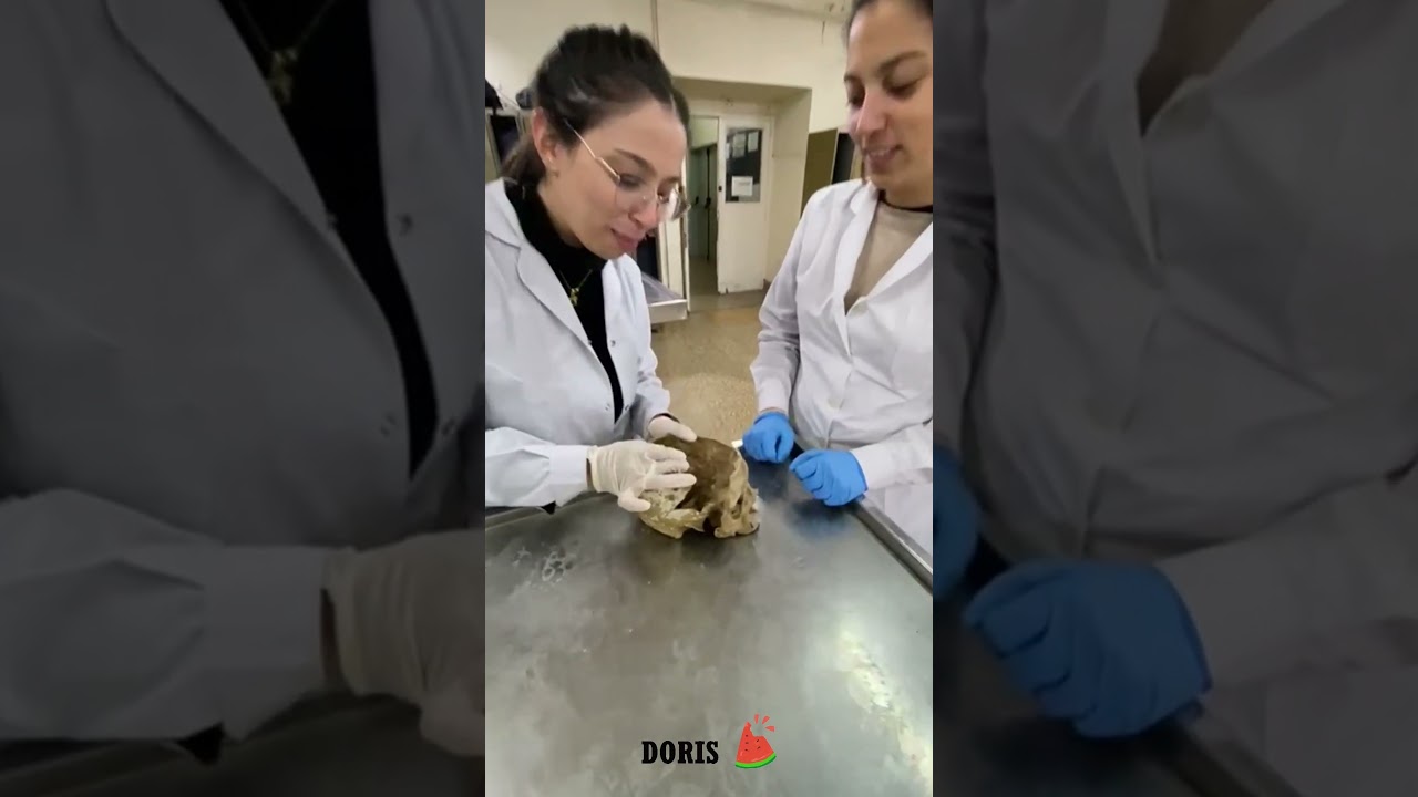 MI PRIMERA CHAMBA VERSI&Oacute;N FMED #doris #fmed  #uba  #anatomia