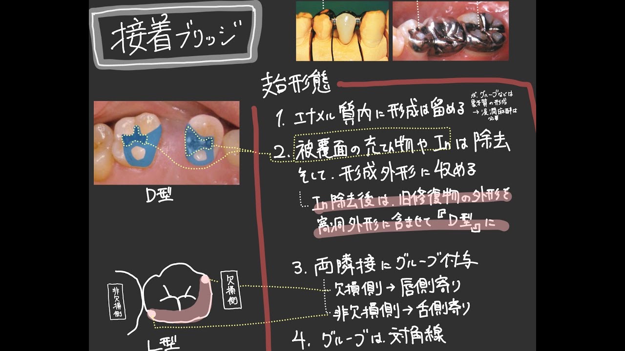 クラブリ総論１