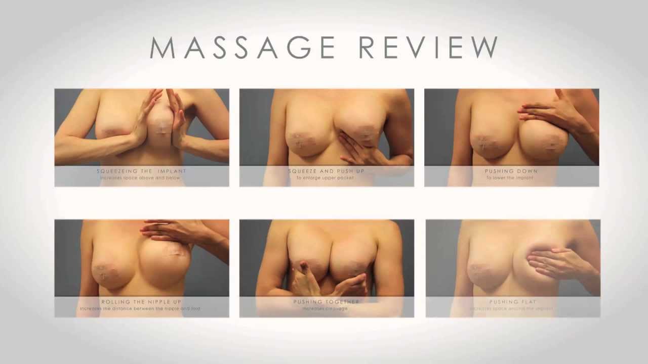 Breast Augmentation Implant Massage