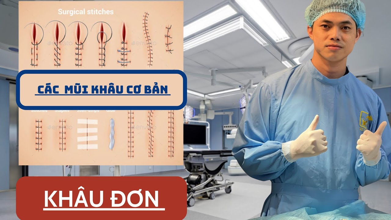 Hướng dẫn thực hiện: Mũi khâu đơn trong phẫu thuật ngoại khoa.