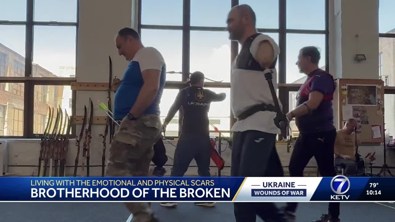 Wounds of War: Part 4 - Survivors of fighting left with lasting emotional and physical scars